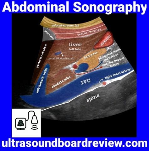 Abdominal Sonography | Sonography, Ultrasound, Diagnostic medical ...