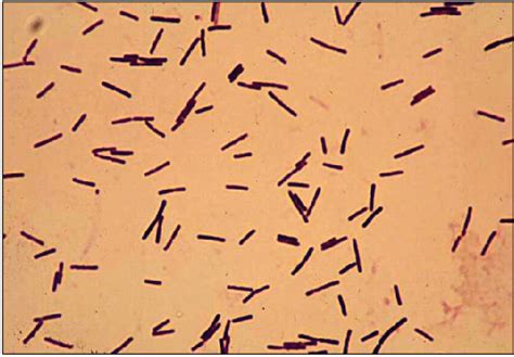 Gram staining of Clostridium difficile. | Download Scientific Diagram