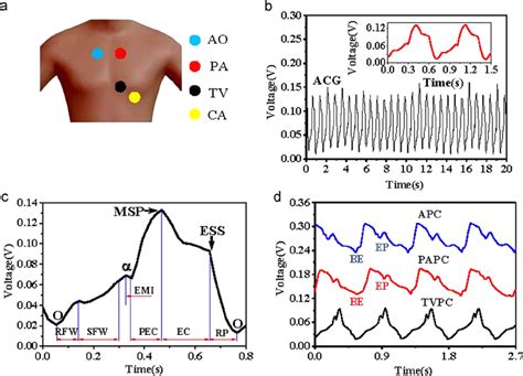 Apex cardiogram recording. (a) The position of the sensors mounted on... | Download Scientific ...