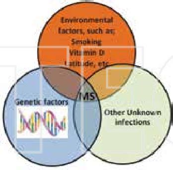 Multiple sclerosis as a complex neurological condition affecting CNS:... | Download Scientific ...