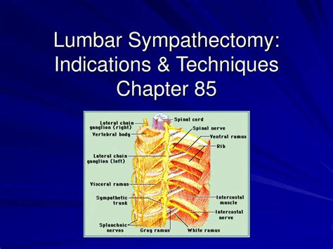 PPT - Lumbar Sympathectomy: Indications & Techniques Chapter 85 PowerPoint Presentation - ID:261637