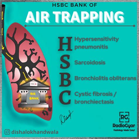 Causes of Air Trapping on CT - Visual Mnemonics - RadioGyan