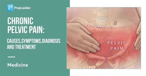 Chronic Pelvic Pain: Causes, Symptoms, Diagnosis and Treatment