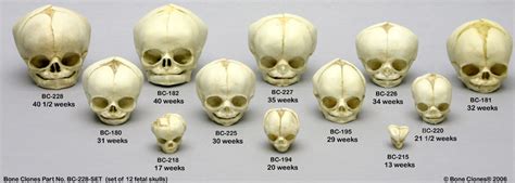 MTI: Missing Tooth Investigators: MALE CHILD?