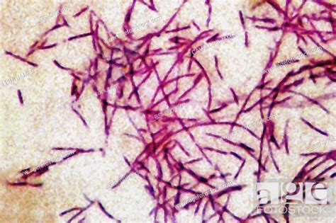LEGIONELLA Legionella pneumophila, the bacteria responsible for Legionellosis or Legionaire's ...