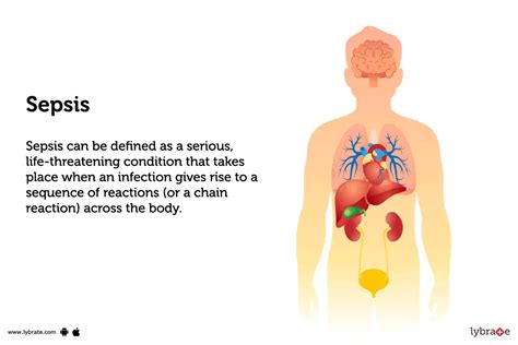 Sepsis Infection