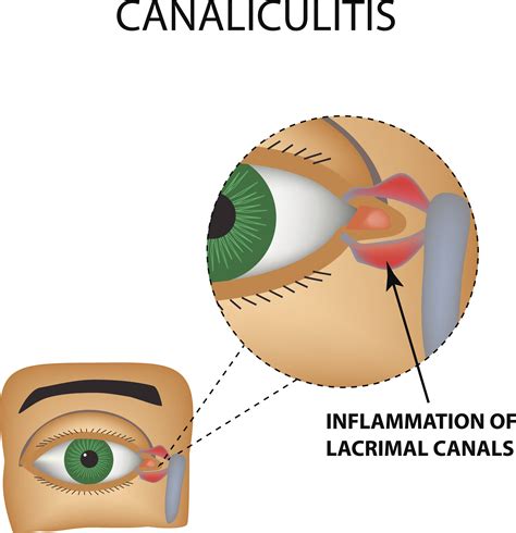 Cosmetic Eyelid Surgery | Blepharoplasty | Mobile, AL Alabama