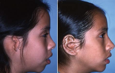 Facial birth deformities – Little Baby Face