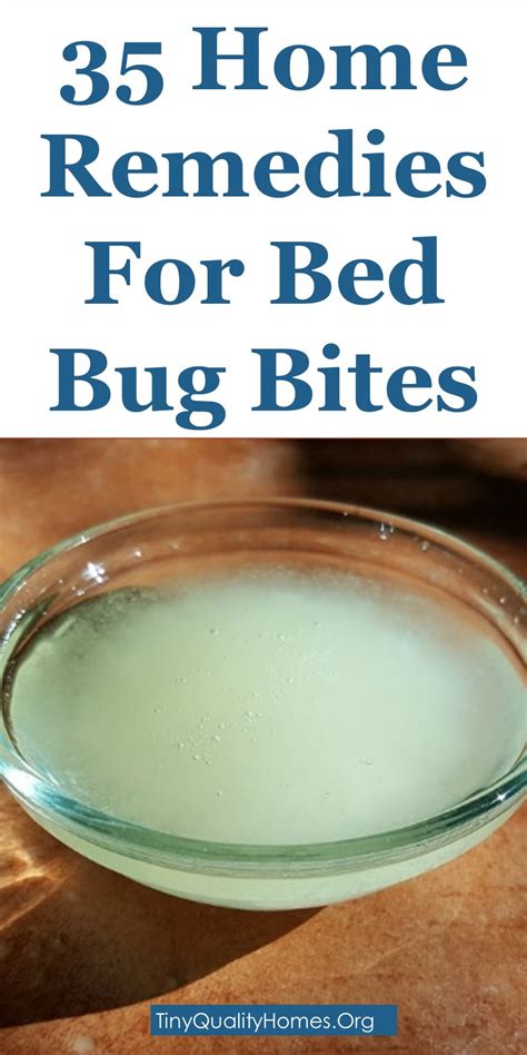 How To Get Rid Of Bed Bug Bites – 35 Home Remedies