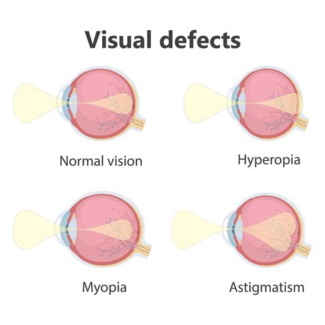 How Glasses Work to Correct Vision | MooMooMath and Science