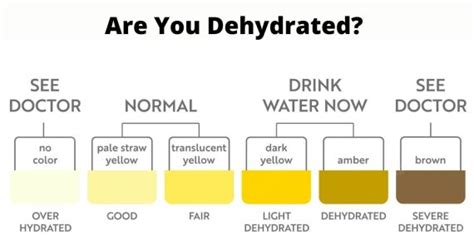 Urine Color Meaning | Adult & Pediatric Urology | Urine Color Chart