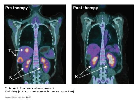 Potential Tactics for Defeating Cancer - A Toolkit in 1,000 Words - The Blog of Author Tim Ferriss