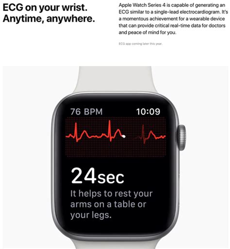 Apple Watch Series 4 ECG Feature is US Only, Not Available in Canada | iPhone in Canada Blog