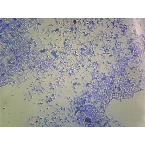 Prepared Microscope Slide,Lactobacillus Casei, Lactic Acid