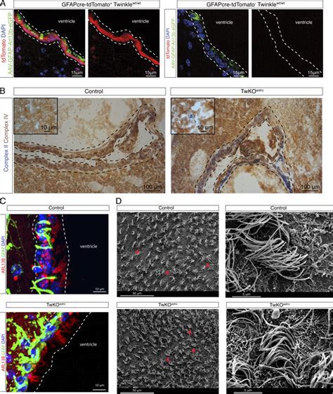 Ependymal multiciliated cells show no major abnormality upon... | Download Scientific Diagram