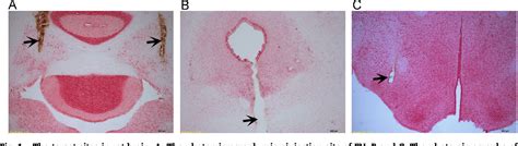 Structure of decussation of superior cerebellar peduncles | Semantic Scholar