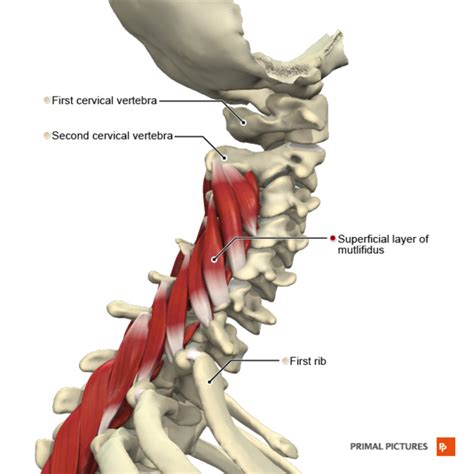 Cervical Myelopathy - Physiopedia