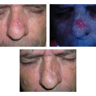 Location and response of the BCC in the nose. | Download Scientific Diagram