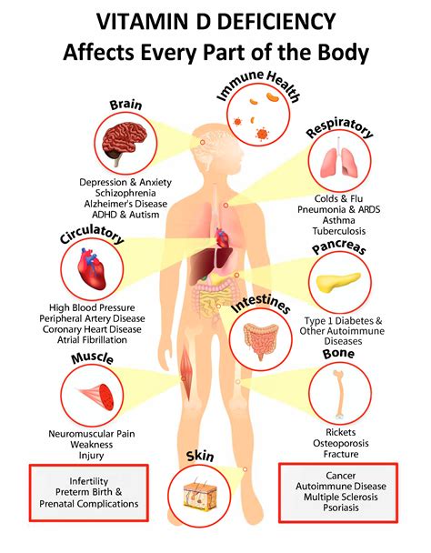 Interactive PDF: How Vitamin D Deficiency Affects Every Part of the ...