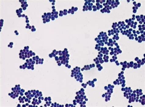 Staphylococcus sp. (simple stain, methylene blue) | MicroLab 1: Microscopy | Pinterest | Simple ...