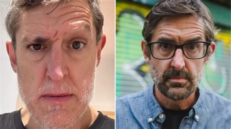 Louis Theroux seriously considers ‘big step’ after losing eyebrows to health condition-Robert ...