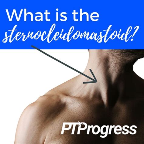 All About the Sternocleidomastoid Muscle: Anatomy and Treatment