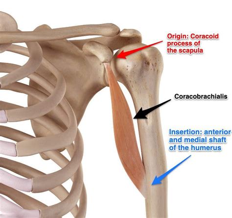 Trigger Points Affecting The Upper Arm Muscles - El Paso, TX | Sciatica ...