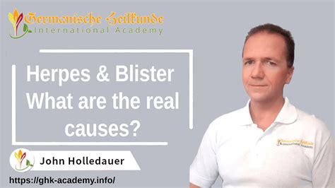 Herpes & Blister - What are the real causes? - GHk Academy