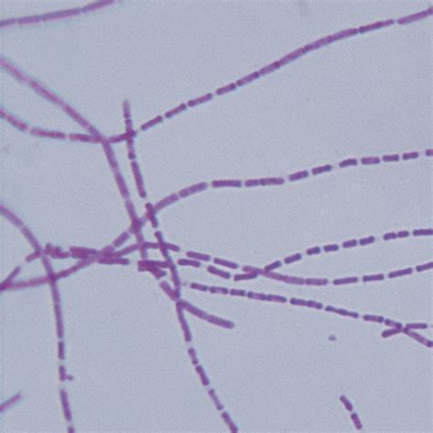 Bacterial Pathogens Microscope Slide Set - Southern Biological