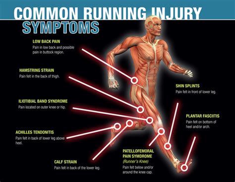 Common Running Injuries [Infographic] - Yuri in a Hurry