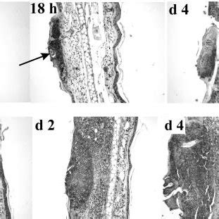 (PDF) Cercarial Dermatitis Caused by Bird Schistosomes Comprises Both Immediate and Late Phase ...