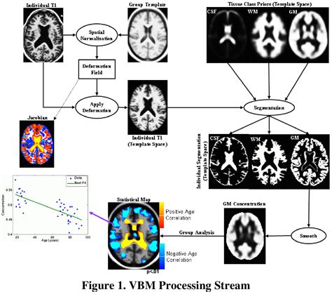 Figure 1 from An Absolute Beginner's Guide to Surface- and Voxel-based Morphometric Analysis ...