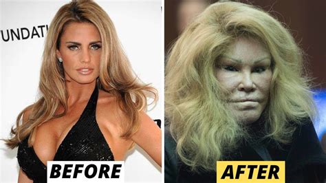 15 Celebrity Plastic Surgery Disasters - YouTube in 2022 | Bad ...