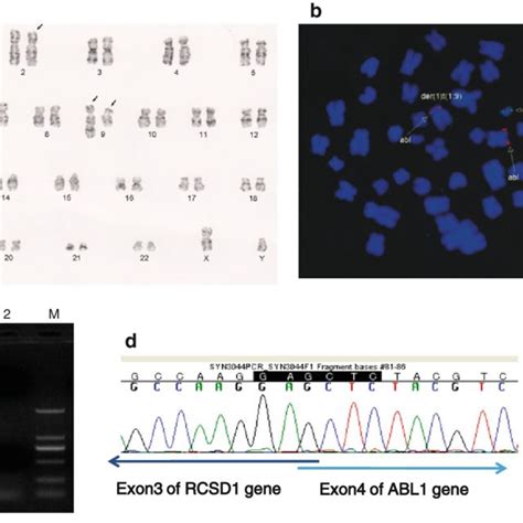 Cytogenetic characterization of the karyotype at the Day 180. a... | Download Scientific Diagram