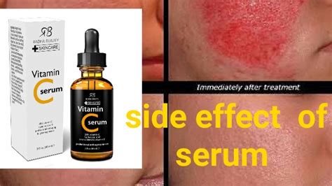 Side effect of Serum.... সিরাম আামাদের ত্বকে কি ক্ষতি করে জেনে নিন - YouTube