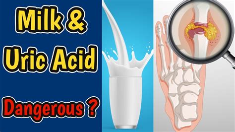 Can U Take Milk In High Uric Acid | Milk And Uric Acid Relation | Gout Diet | - YouTube