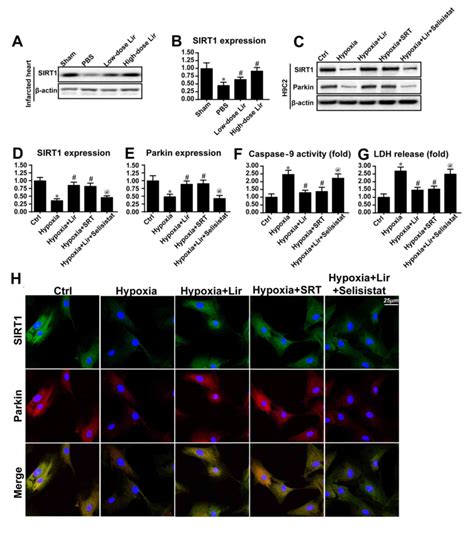 Liraglutide repairs the infarcted heart: The role of the SIRT1/Parkin/mitophagy pathway