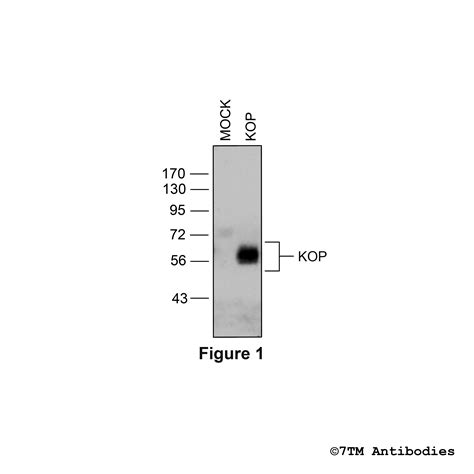 KOP (non-phospho), κ-Opioid Receptor Antibody | 7TM Antibodies