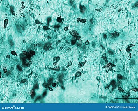 Fungus Like Growth Under the Microscope Stock Image - Image of oomycetes, growing: 160476143