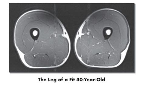 How Age Affects Muscle Growth