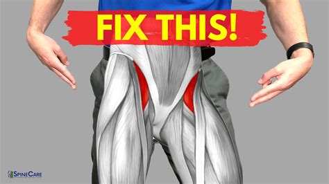 How to Relieve Hip Flexor Pain in 30 SECONDS | SpineCare