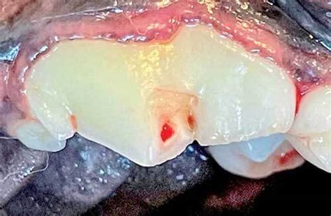 What Causes Tooth Abscess In Dogs