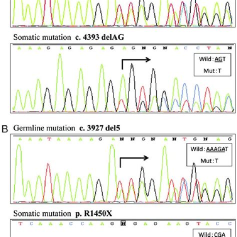 (A) APC gene analysis for Tumor 1. Two mutations were identified... | Download Scientific Diagram