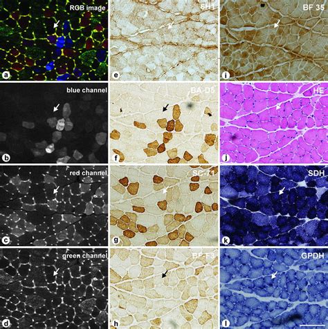 Fiber-type differentiations as revealed by dark microscopy (a–d) of a... | Download Scientific ...