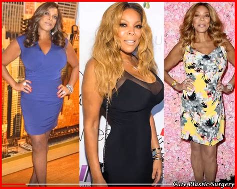 Wendy Williams Plastic Surgery - Celebrities Plastic Surgery