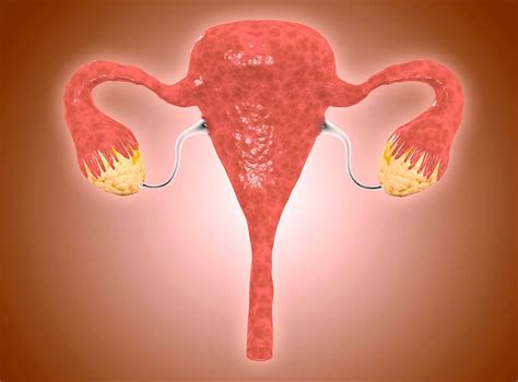 PCOS: what are the symptoms of Polycystic Ovary Syndrome and how is it treated? | The ...