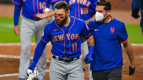 New York Mets' Kevin Pillar bloodied by fastball to face as injury ...