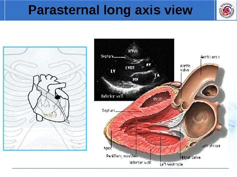 Transthoracic Echocardiography. Standard Imaging of A.