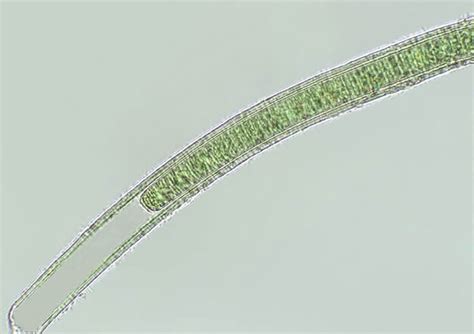 Oscillatoria | The Blue Green Algae (Guide 2024)