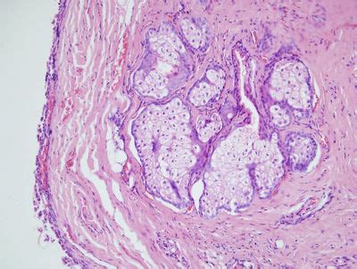 Eye Histology - Tarsal plate - histology slide